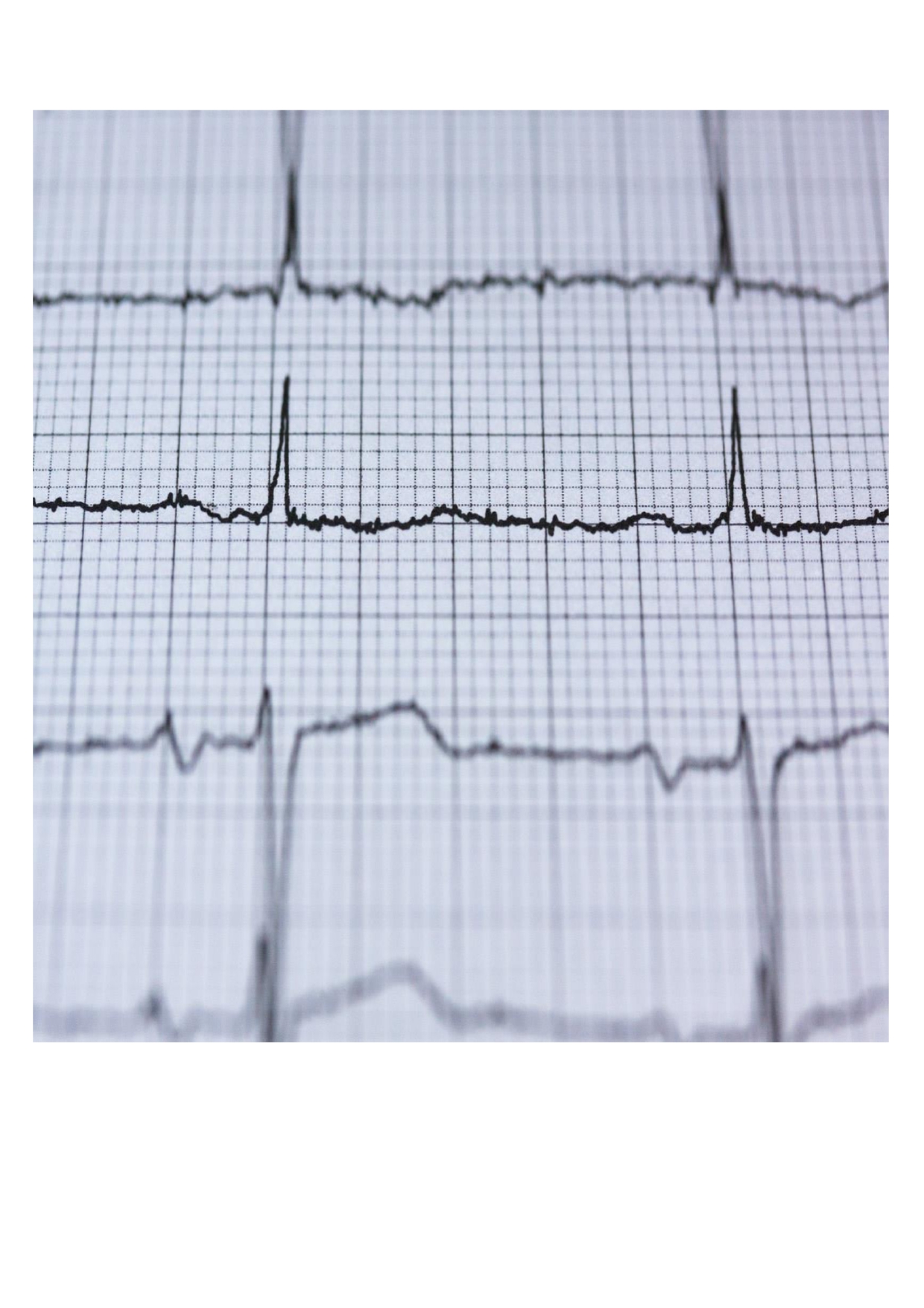 Curso de Formação em ECG Básico | Eventos